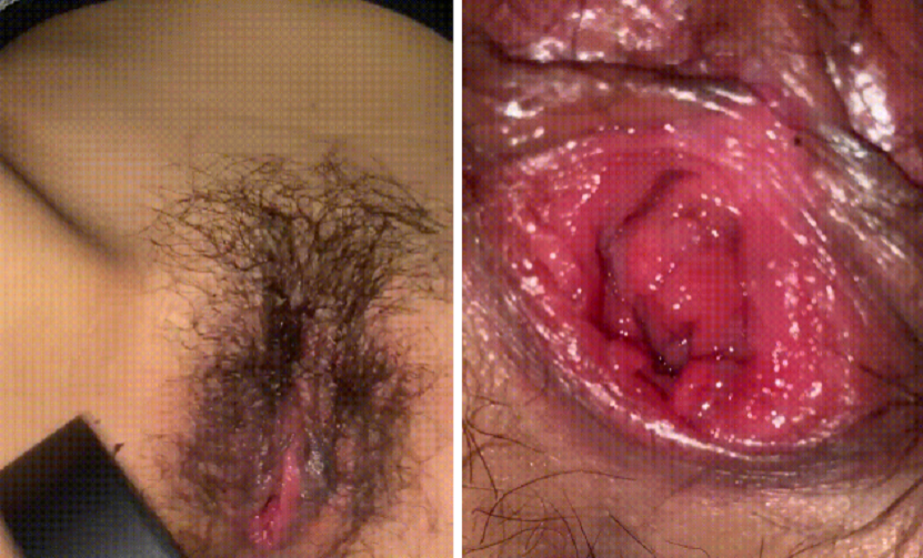 [KBJ] 신작 ✨ 보지털 태우기때리기